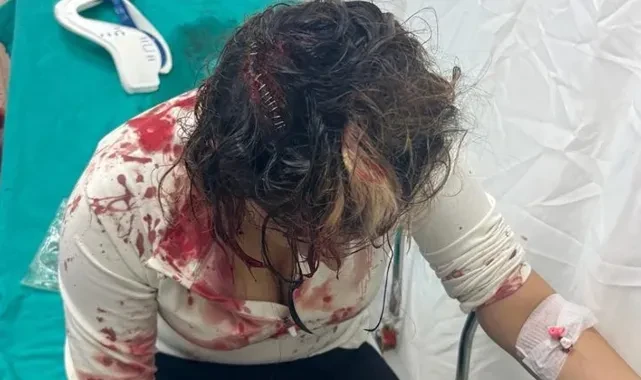 Fuhuş, öldüresiye dayak... 2 çocuk annesine akıl almaz işkence