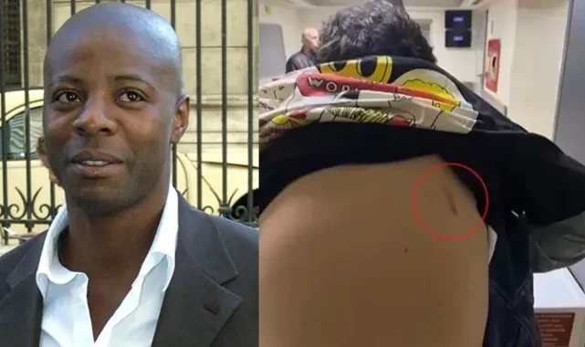 Pascal Nouma 2 çocuğu darbetti