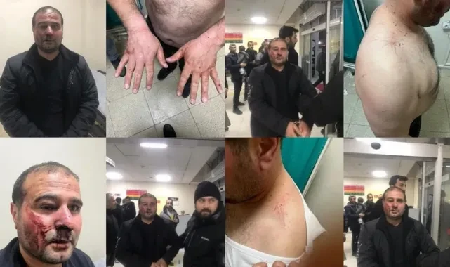 Polis merkezinde feci dayak! Amatör maçta çıkan olaylar sonrası gözaltına kişiye polis merkezinde darbedildi. Valilik soruşturma başlattı