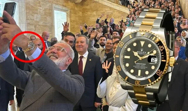 AKP'de Istakozun ardından ikinci vaka: Rolex'li vekil