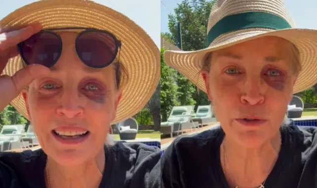 Türkiye’ye gelen Sharon Stone kaza geçirdi: Kimse bana bir şey yapmadı