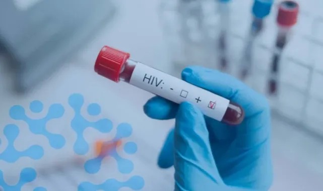 HIV tedavisinde devrim niteliğinde yöntem: 'Hepimizi şaşkına çevirdi'