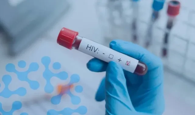 HIV tedavisinde devrim niteliğinde yöntem: 'Hepimizi şaşkına çevirdi'