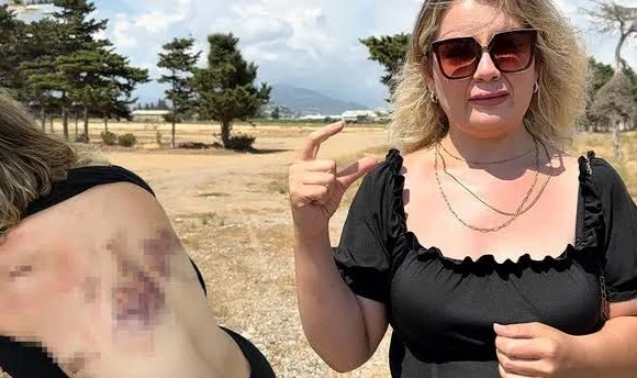 7 Kez Uzaklaştırma Kararı Aldırdı! Eski Sevgilisinin Bıçaklı Saldırısına Uğradı: 'Bıçak Kırılmasaydı Yaşama Şansım Yoktu'